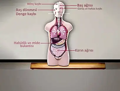 Karbonmonoksit Zehirlenme Belirtileri
